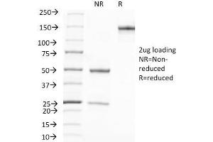 SDS-PAGE Analysis Purified PSA Mouse Monoclonal Antibody (A67-B/E3). (Prostate Specific Antigen anticorps)