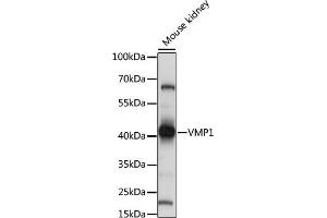 Western blot analysis of extracts of mouse kidney, using VMP1 antibody (ABIN7271283) at 1:1000 dilution.