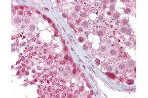 Anti-IFT88 antibody IHC of human testis.