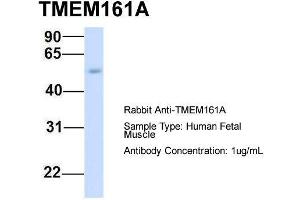 Host:  Rabbit  Target Name:  TMEM161A  Sample Type:  Human Fetal Muscle  Antibody Dilution:  1. (TMEM161A anticorps  (Middle Region))