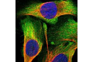 Immunofluorescent staining of human cell line U-2 OS shows localization to plasma membrane & cytosol.