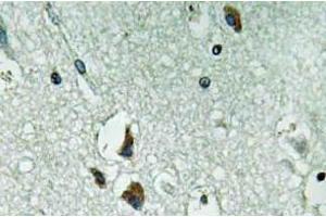 Immunohistochemistry (IHC) analyzes of PAH antibody in paraffin-embedded human brain tissue. (Phenylalanine Hydroxylase anticorps)