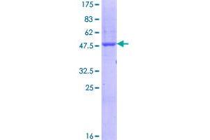 Image no. 1 for Sodium Channel, Voltage-Gated, Type I, beta (SCN1B) (AA 1-218) protein (GST tag) (ABIN1319273)