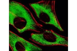 Fluorescent image of HeLa cells stained with RPS6 antibody at 1:25 dilution.