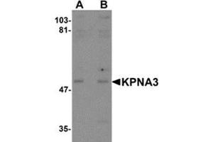 Western blot analysis of KPNA3 in EL4 cell lysate with KPNA3 antibody at (A) 1 and (B) 2 μg/ml. (KPNA3 anticorps  (C-Term))