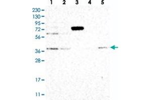 Western blot analysis of Lane 1: RT-4, Lane 2: U-251 MG, Lane 3: Human Plasma, Lane 4: Liver, Lane 5: Tonsil with STRAP polyclonal antibody  at 1:250-1:500 dilution.