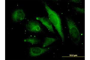 Immunofluorescence of monoclonal antibody to MAPRE2 on HeLa cell.