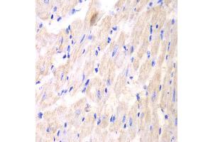 Immunohistochemistry of paraffin-embedded mouse heart using YWHAQ antibody at dilution of 1:100 (400x lens). (14-3-3 theta anticorps)