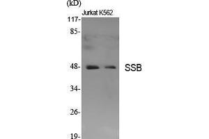 Western Blot (WB) analysis of specific cells using SSB Polyclonal Antibody. (SSB anticorps  (Ser366))