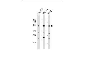 All lanes : Anti-SLC9A3R1 Antibody (Center) at 1:2000 dilution Lane 1: HepG2 whole cell lysate Lane 2: MCF-7 whole cell lysate Lane 3: T47D whole cell lysate Lysates/proteins at 20 μg per lane. (SLC9A3R1 anticorps  (AA 168-197))