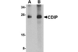 Western blot analysis of CDIP in human brain lysate with AP30219PU-N CDIP antibody at (A) 1 and (B) 2 μg/ml. (CDIP1 anticorps  (Center))