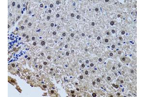 Immunohistochemistry of paraffin-embedded rat liver using SIN3A antibody. (SIN3A anticorps)