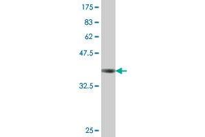 Western Blot detection against Immunogen (38.