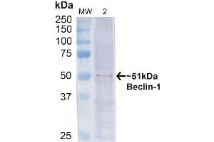 Western blot analysis of Human Cervical cancer cell line (HeLa) lysate showing detection of ~51 kDa Beclin 1 protein using Rabbit Anti-Beclin 1 Polyclonal Antibody (ABIN2868740). (Beclin 1 anticorps  (Atto 390))