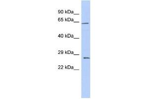 WB Suggested Anti-CLDN18 Antibody Titration:  0. (Claudin 18 anticorps  (Middle Region))