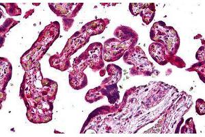 Human Placenta: Formalin-Fixed, Paraffin-Embedded (FFPE) (Sorting Nexin 4 anticorps  (AA 438-450))