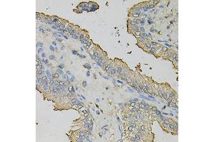 Immunohistochemistry of paraffin-embedded human prostate using AZGP1 Antibody (ABIN5973101) at dilution of 1/100 (40x lens).