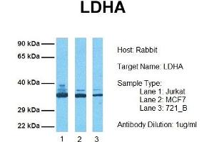 Host: Rabbit Target Name: LDHA Sample Tissue: Human Jurkat, MCF7, 721_B Antibody Dilution: 1. (Lactate Dehydrogenase A anticorps  (Middle Region))