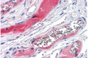 Human Small Intestine, Vessels (formalin-fixed, paraffin-embedded) stained with KLKB1 antibody ABIN351494 at 5 ug/ml followed by biotinylated secondary antibody, alkaline phosphatase-streptavidin and chromogen.