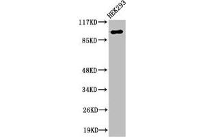 Western Blot analysis of 293 cells using RoXaN Polyclonal Antibody (ZC3H7B anticorps  (C-Term))
