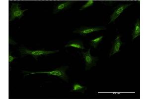 Immunofluorescence of monoclonal antibody to CTNND2 on HeLa cell. (CTNND2 anticorps  (AA 1081-1190))