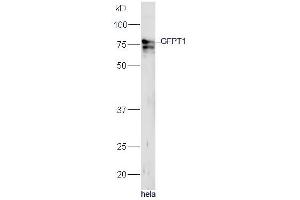 Human HeLa lysates probed with Rabbit Anti-GFPT1 Polyclonal Antibody, Unconjugated (ABIN1714093) at 1:300 overnight at 4˚C.