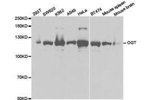 Western Blotting (WB) image for anti-O-Linked N-Acetylglucosamine (GlcNAc) Transferase (UDP-N-Acetylglucosamine:polypeptide-N-Acetylglucosaminyl Transferase) (OGT) antibody (ABIN1874000) (OGT anticorps)