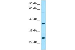 WB Suggested Anti-DTD1 Antibody Titration: 1. (DTD1 anticorps  (C-Term))