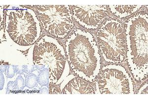 anti-Mitogen-Activated Protein Kinase 1/3 (MAPK1/3) (AA 300-380) antibody