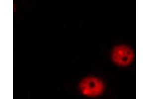 ABIN6267317 staining MOLT by IF/ICC. (Retinoblastoma 1 anticorps  (pSer807))