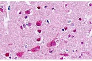 Human Brain, Cortex: Formalin-Fixed, Paraffin-Embedded (FFPE)