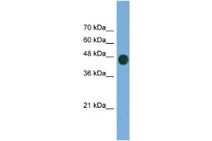 WB Suggested Anti-ARFGAP1 Antibody Titration: 0. (ARFGAP1 anticorps  (Middle Region))