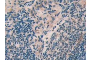 Detection of IL18 in Rat Spleen Tissue using Polyclonal Antibody to Interleukin 18 (IL18)