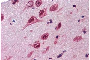 anti-Ubiquilin 1 (UBQLN1) (AA 290-339) antibody