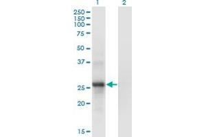 Western Blot analysis of SNF8 expression in transfected 293T cell line by SNF8 monoclonal antibody (M01), clone 6B11. (SNF8 anticorps  (AA 23-122))