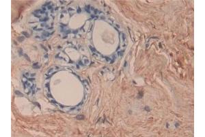 Detection of COL6a3 in Human Mammary gland Tissue using Polyclonal Antibody to Collagen Type VI Alpha 3 (COL6a3)