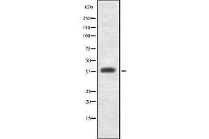 Western blot analysis GDF1 using K562 whole cell lysates (GDF1 anticorps  (N-Term))