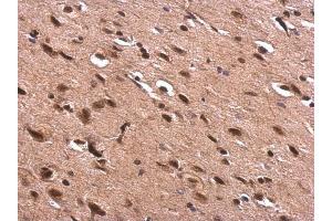 IHC-P Image AChE antibody detects AChE protein at nucleus on rat fore brain by immunohistochemical analysis.