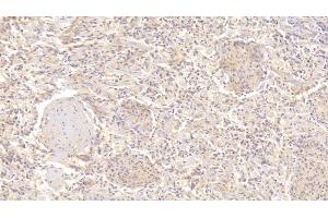 Detection of UBR4 in Human Spleen Tissue using Polyclonal Antibody to Ubiquitin Protein Ligase E3 Component N-Recognin 4 (UBR4)