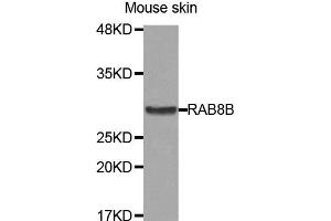 Western Blotting (WB) image for anti-RAB8B, Member RAS Oncogene Family (RAB8B) antibody (ABIN1875675) (RAB8B anticorps)