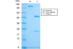 SDS-PAGE Analysis Purified CD79b Recombinant Rabbit Monoclonal Antibody (IGB/3170R).
