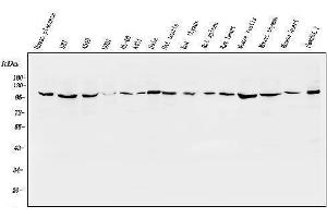 Western blot analysis of ApoER2/LRP8 using anti-ApoER2/LRP8 antibody (ABIN7601752).