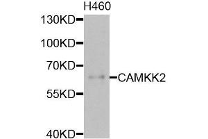 Western blot analysis of extracts of H460 cells, using CAMKK2 antibody (ABIN6003631) at 1/1000 dilution. (CAMKK2 anticorps)