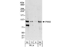 Western Blotting (WB) image for anti-Protein Kinase N3 (PKN3) (AA 225-275) antibody (ABIN7453164)