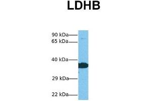 Host:  Rabbit  Target Name:  LDHB  Sample Tissue:  Human Jurkat  Antibody Dilution:  1.