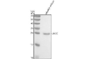 Western blot analysis of LIN7C using anti-LIN7C antibody (AZQ66IB0).