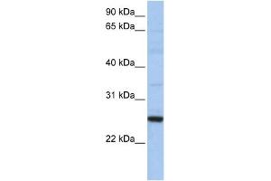 WB Suggested Anti-XBP1 Antibody Titration:  0. (XBP1 anticorps  (N-Term))