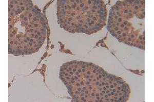 DAB staining on IHC-P; Samples: Rat Testis Tissue