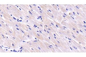 Detection of CSN3 in Bovine Cardiac Muscle Tissue using Polyclonal Antibody to Casein Kappa (CSN3) (CSN3 anticorps  (AA 22-190))