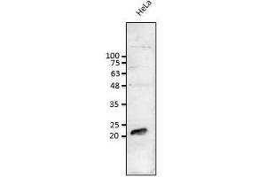 Anti-Rab1b Ab at 1/1,000 dilution: lysates at 50 µg per Iane, rabbit polyclonal to goat (HRP) at 1/10,000 dilution, (RAB1B anticorps  (C-Term))